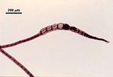 8 - Tetrasporocisti